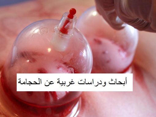 أبحاث ودراسات غربية عن الحجامة