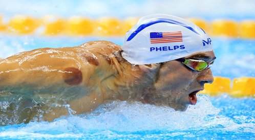 السباح مايكل فيليبس و الحجامة في الأولمبياد